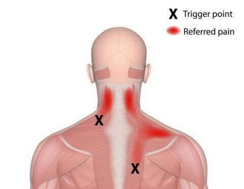 Knots of Pain | Motion Stability